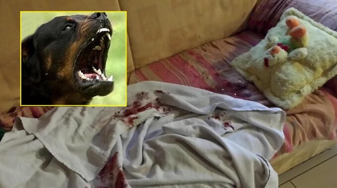 bimbo aggredito cane acerra