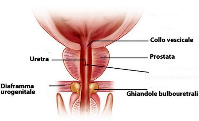 prostatite non batterica cause biopsia próstata