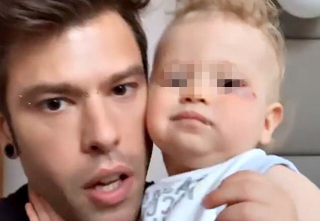 leone figlio fedez si fa male