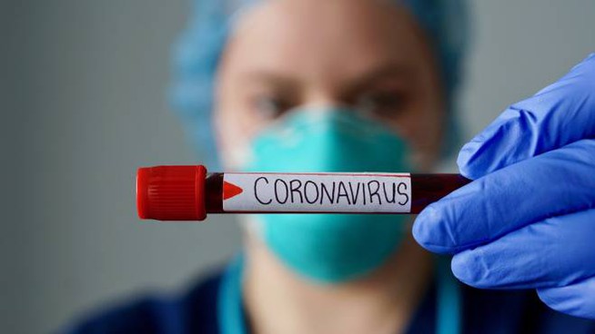 afragola coronavirus