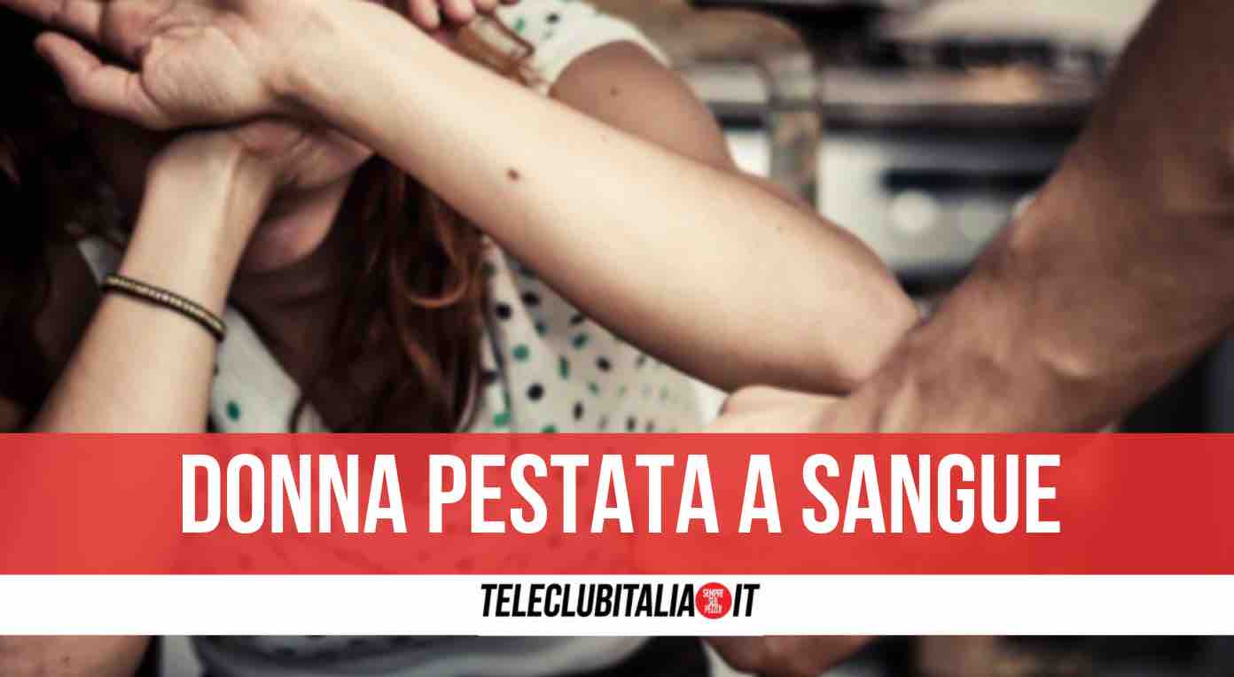 lite famiglia napoli arrestato 41enne lite famiglia napoli arrestato 41enne