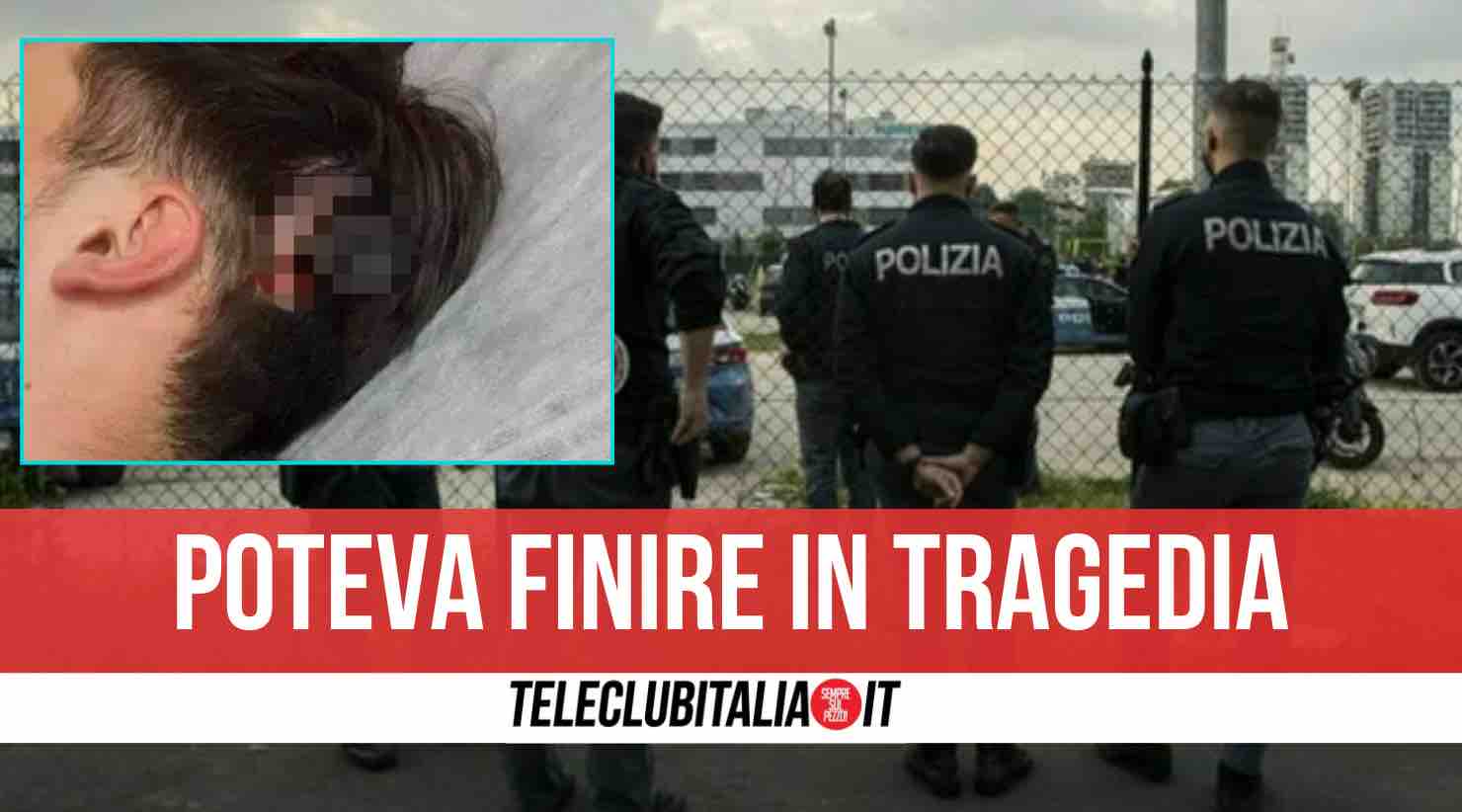 napoli chiave conficcata in testa partita calcetto napoli chiave conficcata in testa partita calcetto