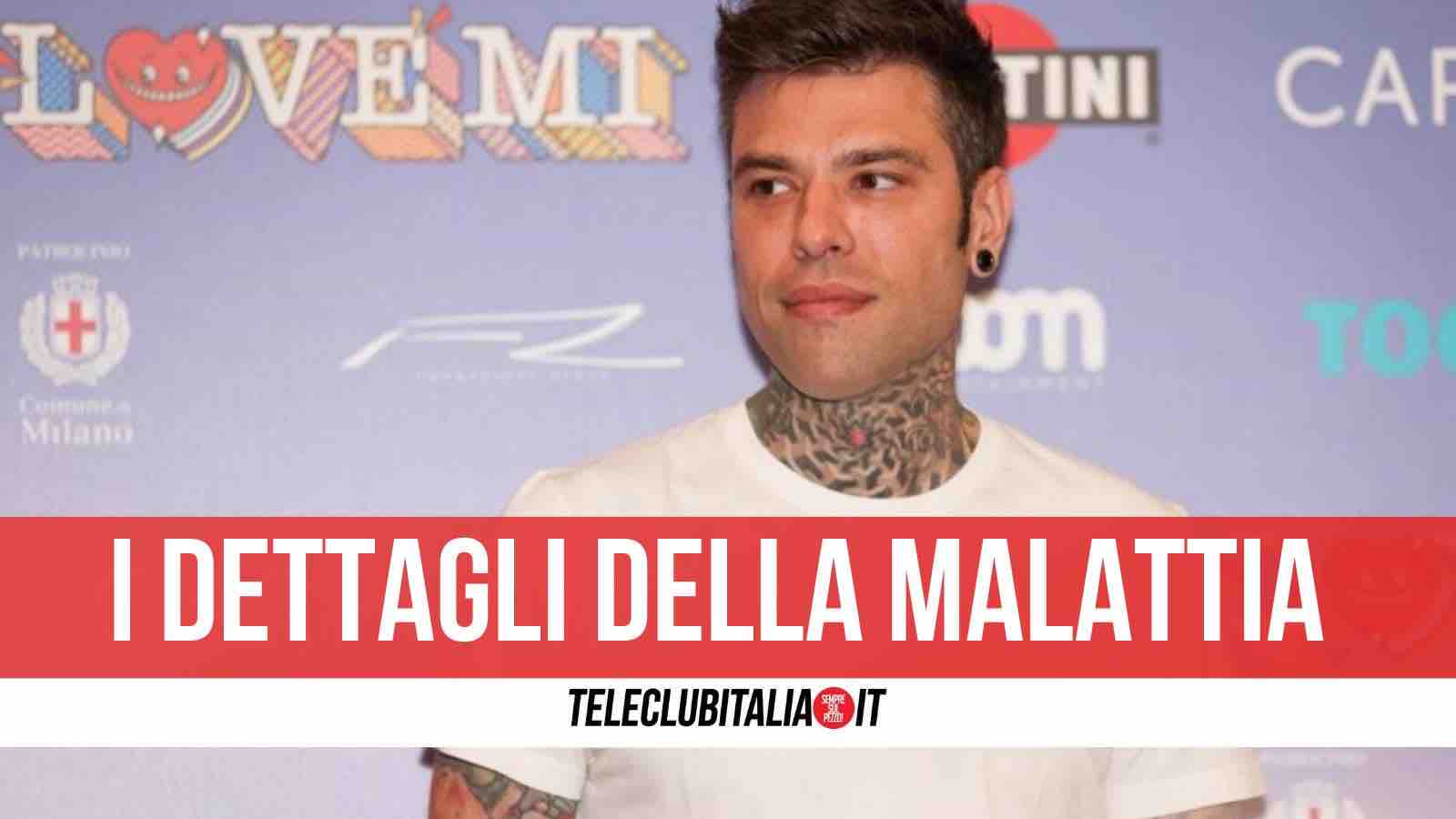 fedez tumore