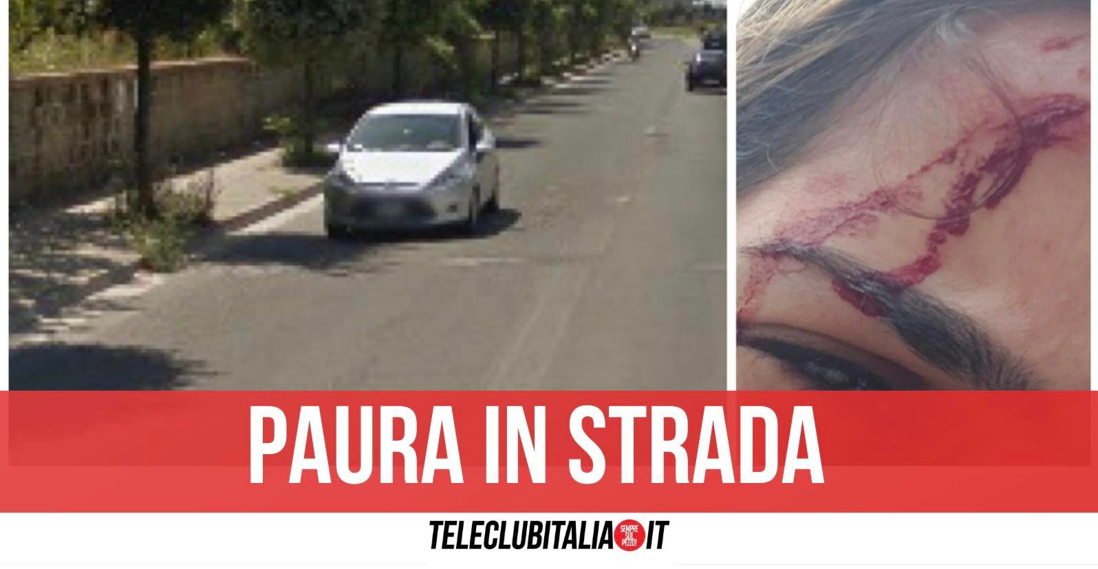 villaricca testata ragazza aggredita via campana villaricca testata ragazza aggredita via campana