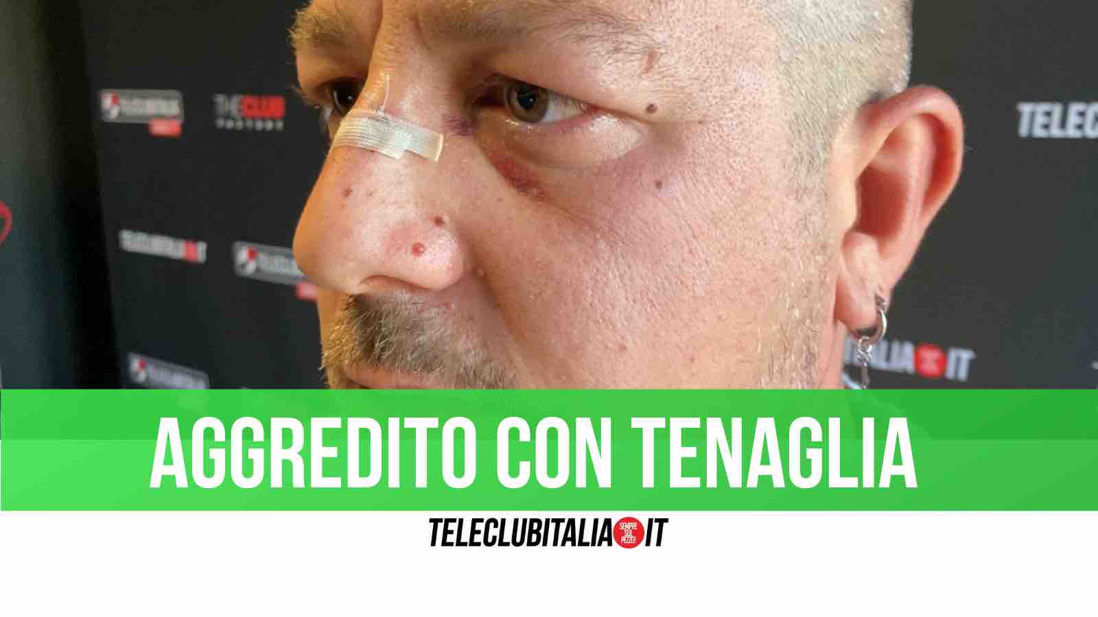 ausiliare aggredito giugliano