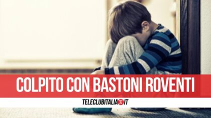 Campania. Bimbo di 10 anni con piedi ustionati: la punizione per non aver pulito casa