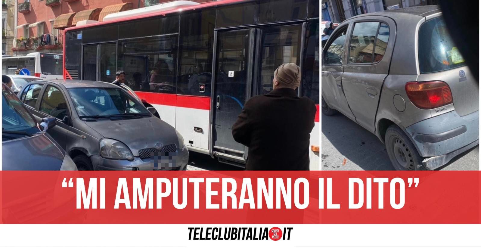 Mano Spappolata Capodichino Napoli