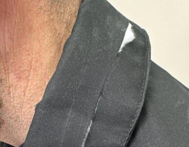 Carabiniere Salvato Da Taglierino Marano Arrestato 46enne