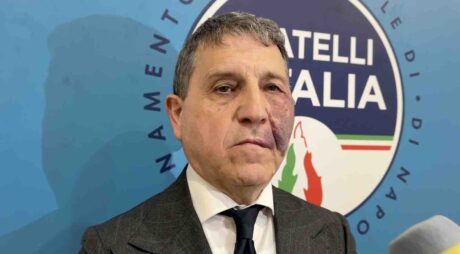 schiano