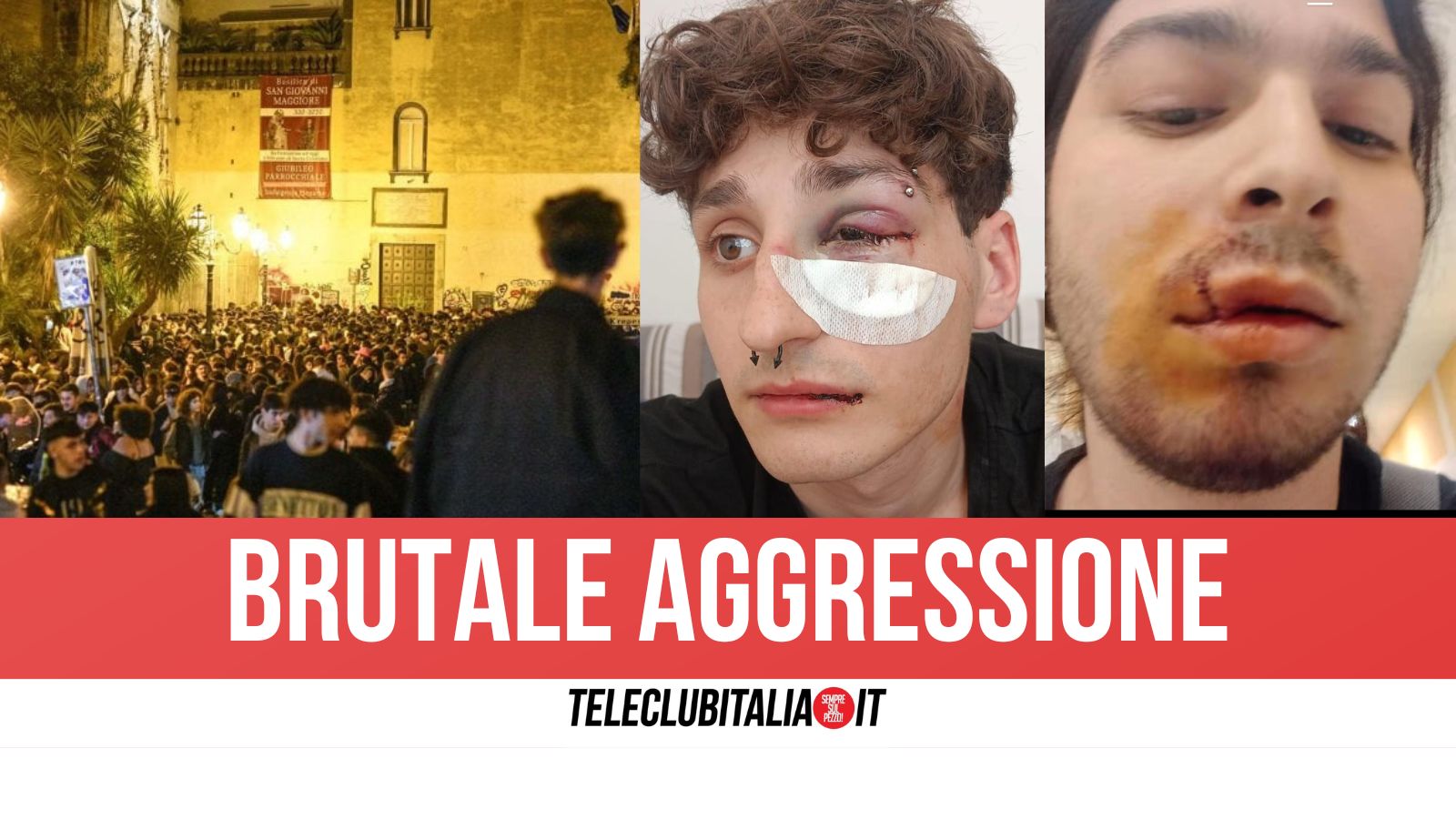 napoli aggredito per scarpa sporcata in due pestati durante la movida
