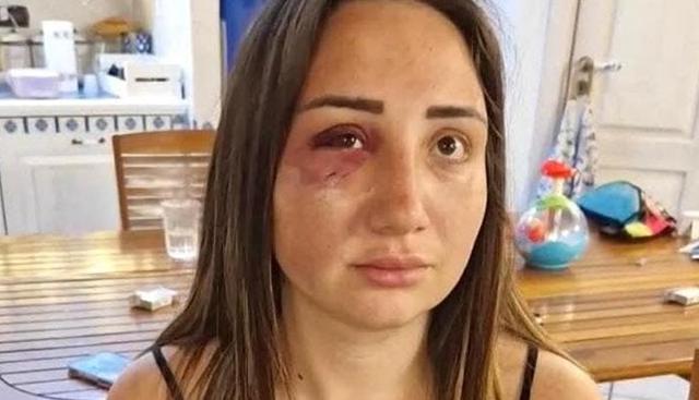 Picchiata Belvedere Presi Due Complici Pozzuoli