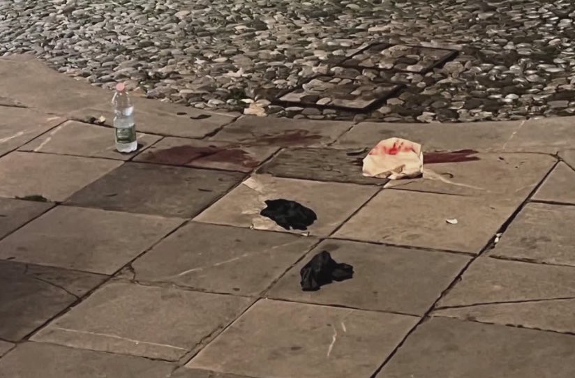 Napoli, 22enne accerchiato e accoltellato da sconosciuti senza motivo: indaga la Polizia