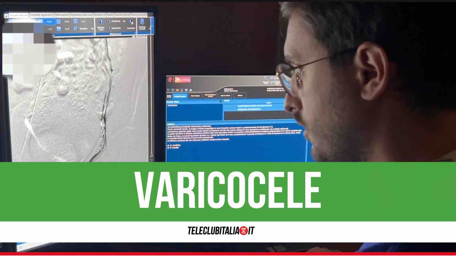 varicocele che cos8217232 e come si interviene in radiologia