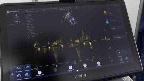 Le sentinelle del cuore, la prevenzione che salva la vita