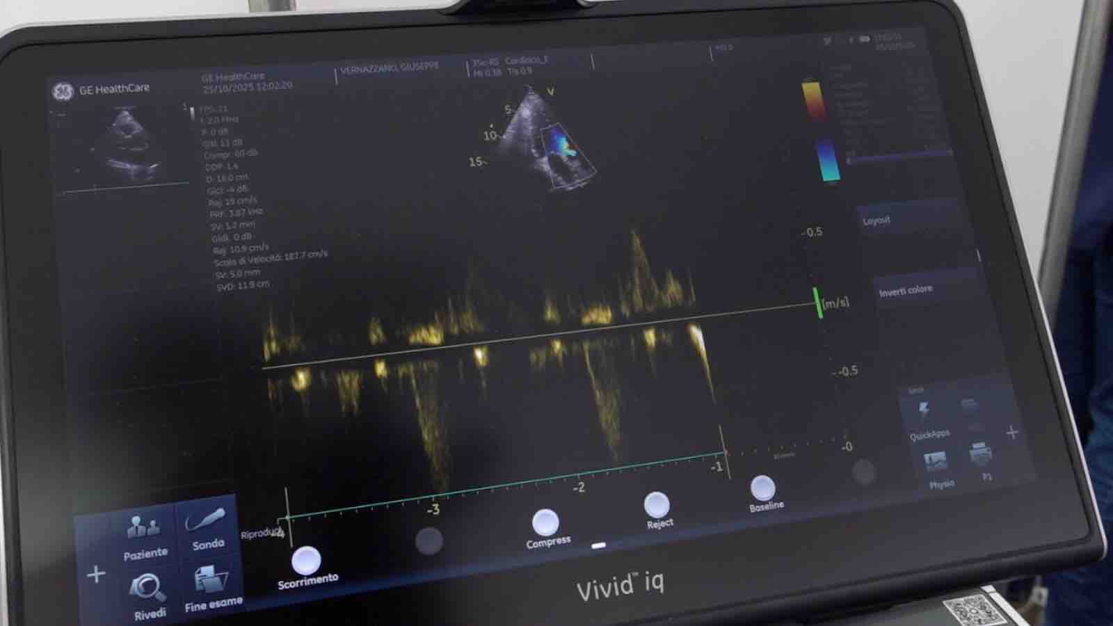 Le sentinelle del cuore, la prevenzione che salva la vita