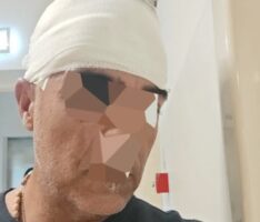 Autista bus chiede il biglietto a uno studente: aggredito e picchiato a colpi di smartphone