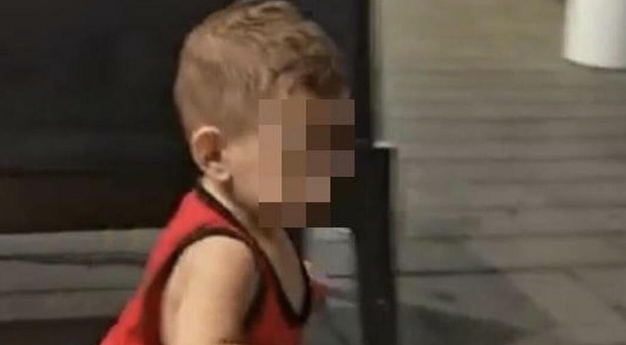 Bimbo trapiantato al Monaldi, resta in terapia intensiva: in arrivo esperti da tutta Italia