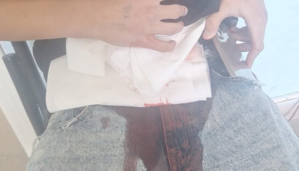 castel volturno studente accoltellato a scuola arrestato 14enne da Teleclubitalia.it castel volturno studente accoltellato a scuola arrestato 14enne